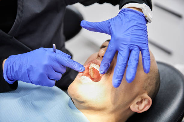 Best Knocked-Out Tooth (Avulsed Tooth) Treatment in Merritt Park, NY